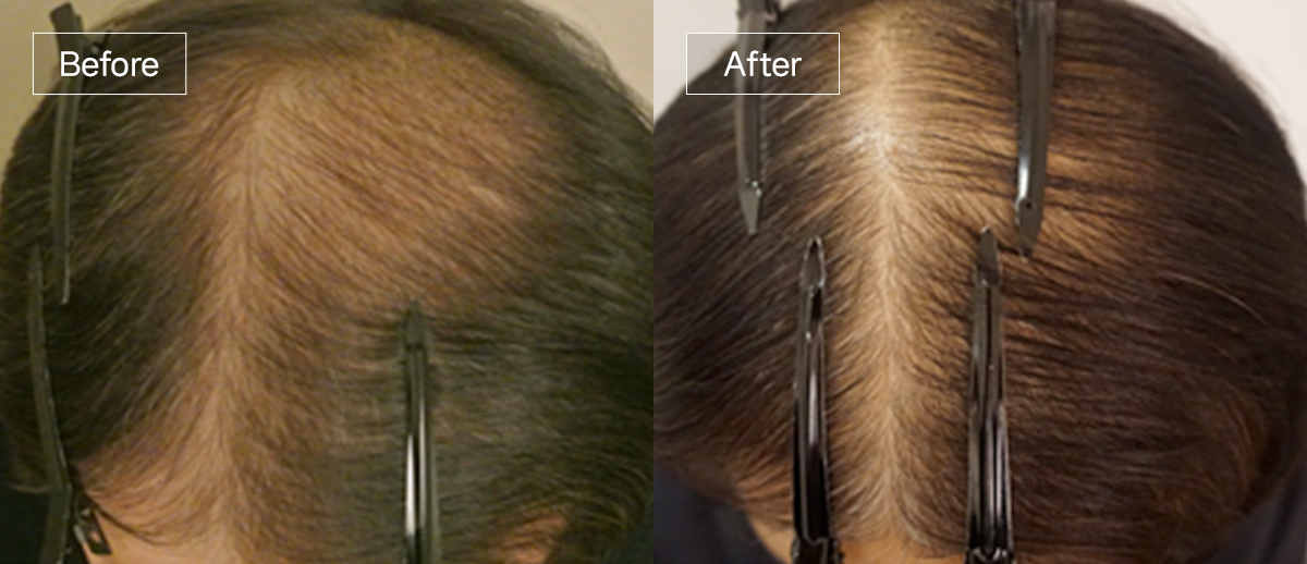 /filedata/md_board/20251229130255_4J1RDNs3_sub4_slide5.jpg 전후사진