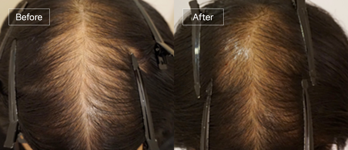 /filedata/md_board/20251229130301_UxrPj84R_sub4_slide6.jpg 전후사진